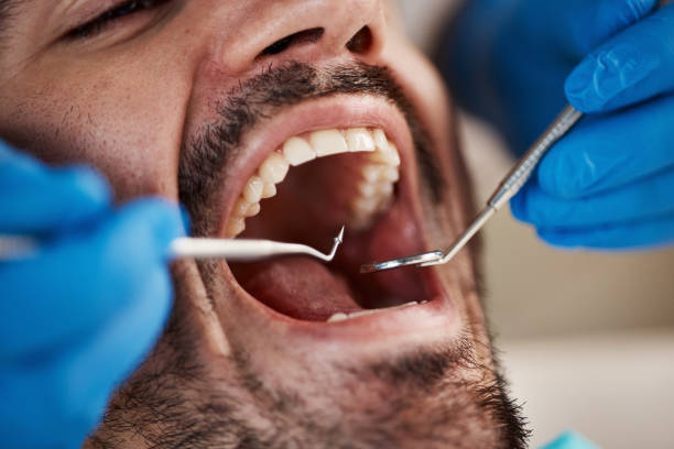 Best Dentist for Tooth Abscess  in Bellefonte, DE